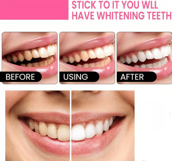 🦷 Niacinamide Whitening Toothpaste - For Healthier, Whiter Teeth!